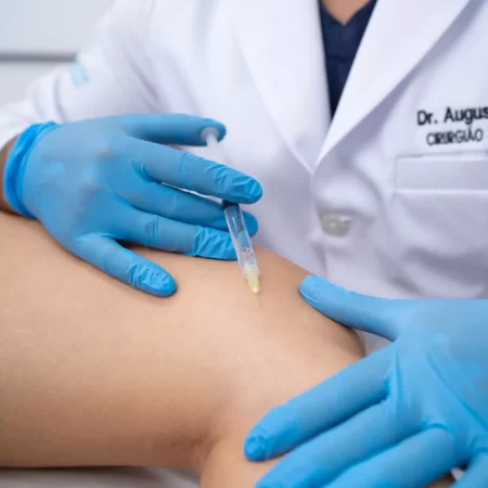Tratamento Escleroterapia